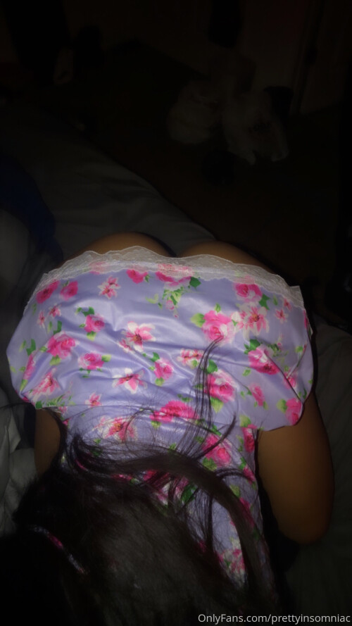PrettyInsomniac Nude Leaked Onlyfans Photo PrettyInsomniac Nude Leaked Onlyfans Photo