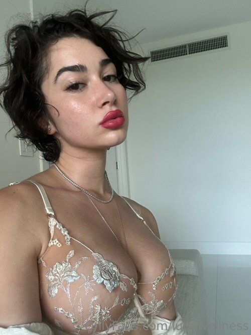 Liz | Lupuwellness Nude Leaked Onlyfans Photo
