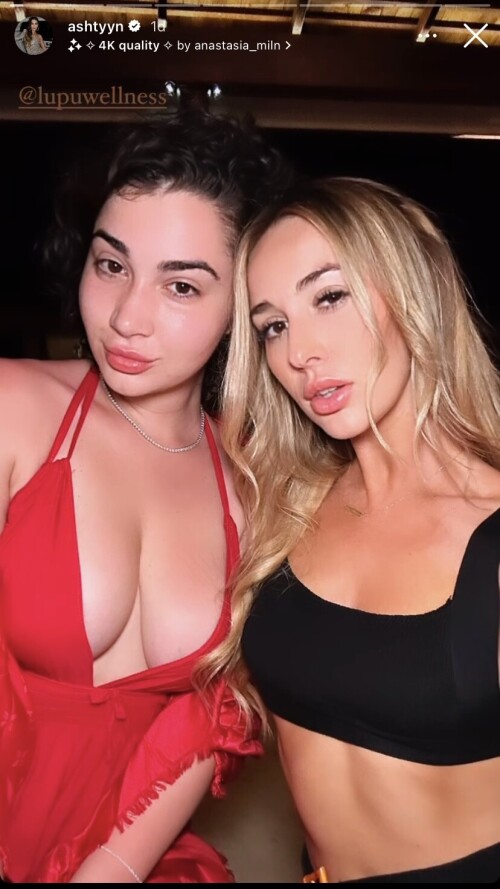 Liz | Lupuwellness Nude Leaked Onlyfans Photo